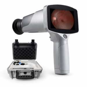 MediWorks Ophthalmic Eye Equipment Non Mydriatic Handheld Fundus Camera Portable Automatic Fundus Camera